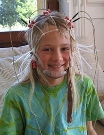 Kind mit einigen EEG-Elektroden