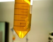 Inuspherese: Das Eluart zeigt einen Immunkomplex.