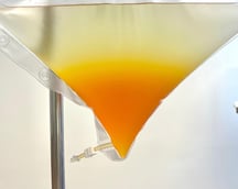 INUSpherese® – Sanfte Blutreinigung. Das Eluat zeigt ein unauffälliges Bild. Es ist ein "Normalbefund".