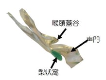 梨状窩に3ccほどしか溜まらない