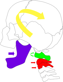 硬い食事による頸椎破壊