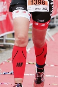 Stosswellen und Ultraschalltherapie bei Cellulite