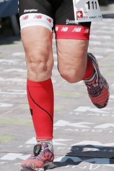 Stosswellen und Ultraschall Therapie bei Cellulite