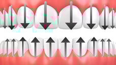 ParoSphère | Brossage débutant