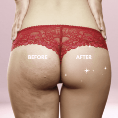 SOIN GLOW-UP FESSIER