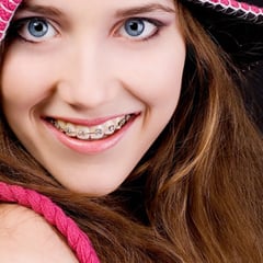 OrtodonciA Smile On!