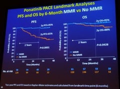 ASH leucémie leucemie LMC traitement lmc france cml myeloide myéloïde chronique leucémie lmc cml leukemia cancer sang moelle osseuse leucocythose philadelphie