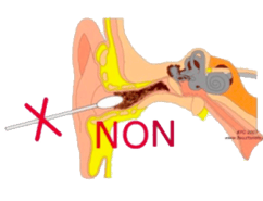 Le coton tige n'est pas une bonne technique pour se nettoyer les oreilles