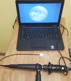 嚥下内視鏡システム