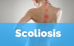 scoliosis