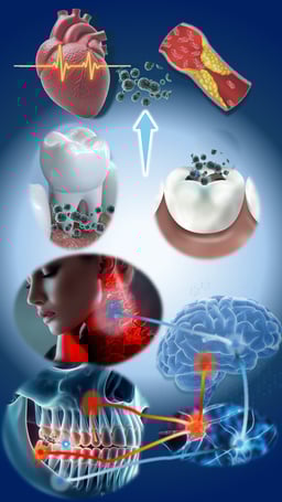 根の病気、虫歯のによる細菌感染は全身の臓器にまで様々な影響を与えます。歯科疾患による痛みは脳に慢性的影響を与え、認知症などの症状の原因に、はの不適切な接触は筋肉の反射を生み、筋肉の緊張を生み出します。
