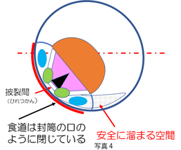体幹が45度傾くと安全に溜まる量が少なくり誤嚥のリスクが高くなる