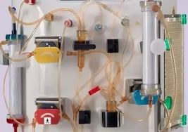 Moderne INUSpherese®-Therapie im Einsatz: Ein Patient erhält eine schonende und revolutionäre Blutwäsche (Apherese) in unserem hochtechnisierten medizinischen Zentrum. Die innovative INUSpherese®-Methode reinigt das Blut präzise von schädlichen Substanzen