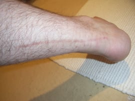 2 Jahre später im Mai 2007