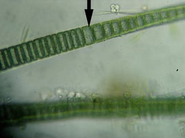 シアノバクテリアの細胞　　Photo by Nat Tarbox