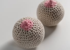 Brustkrebs, bösartiger Tumor, gutartiger Tumor, Krebs, Brustkrebsrisiko