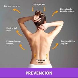 FISIOTERAPIA EN PREVENCIÓN