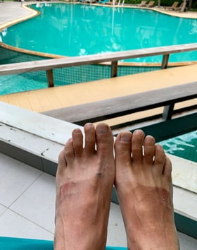 Füsse nicht mit Sonnencrème eingeschmiert?