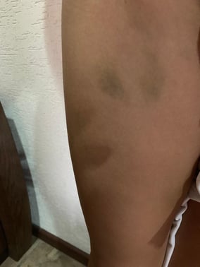 sanacion,angeles,terapia,angelica.curacion,energetica,natural,medicina,pancreatitis,lupus,pancreas,