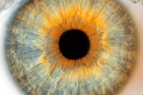 irisdiagnose-naturheilpraxis-naturheilpraxis-meggen