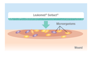 Erstes Foto: auflegen des Cutimed Sorbion Sorbact auf die Mikroorganismen
