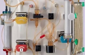 Moderne INUSpherese®-Therapie im Einsatz: Ein Patient erhält eine schonende und revolutionäre Blutwäsche (Apherese) in unserem hochtechnisierten medizinischen Zentrum. Die innovative INUSpherese®-Methode reinigt das Blut präzise von schädlichen Substanzen