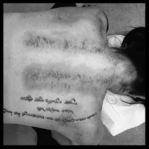 MTC Bienne, Gua Sha, Techniques additionnelles, acupuncture Bienne, médecine traditionnelle chinoise Bienne, acu natura TCM Bienne 