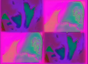 Heute tätowiere ich mich     2003