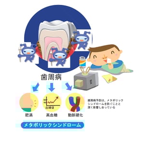 歯周病とメタボ