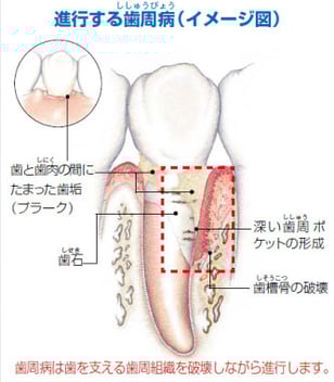 ・エムドゲイン２