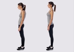 What is sway back posture?