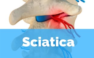 sciatica chiropractor