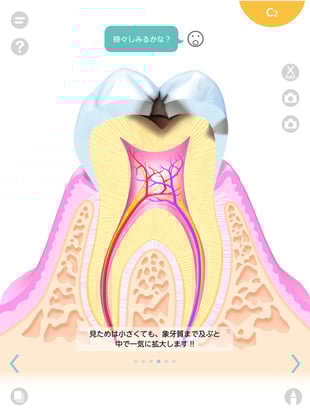 第２巻　むし歯って何？（抜粋）