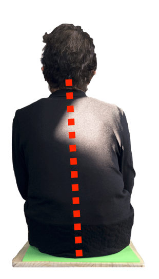 骨盤コントロール補助器「ニュートラル」を使用前の姿勢　姿勢改善・歩き方改善ラボ【㈱n-position】骨盤コントロール補助器「ニュートラル」開発会社