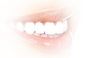 Estética - Blanqueamiento Dental