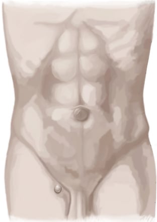 Femoralhernie - Hernienzentrium.Berlin