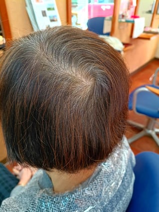 前回から2ヶ月後