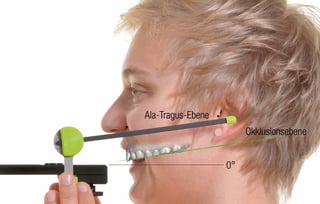 トーシンデンタル　ジルコンザーン　プレーンファインダー　フェイスハンター　プレーンシステム　ナチュラルヘッドポジション（ＮＨＰ）