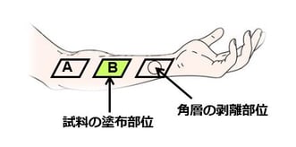 テープストリッピング