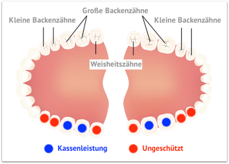 Was bezahlt die Kasse bei der Fissurenversiegelung? (© kyogo7002 - Fotolia.com)