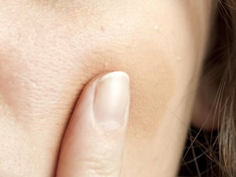 Die Flüssigkeit der Ampulle wird auf die Haut aufgedrückt. Foto: Andrea Warnecke