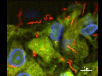 Syphilis bleibt vor allem ein Großstadt-Phänomen. Foto: PD Dr. Annette Moter/Charite-Universitätsmedizin Berlin/Handout/dpa
