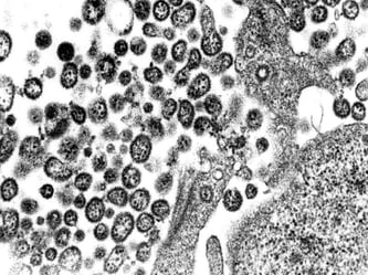 Elektronenmikroskopische Aufnahme von Lassaviruspartikeln aus Zellkulturen. Foto: Bernhard-Nocht-Institut