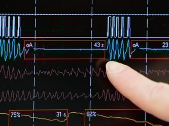 Die meisten Patienten haben während der Nacht immer wieder Atemstillstände (Apnoen). Foto: Daniel Karmann