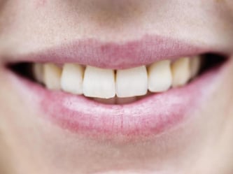 Auch Mundwinkel wollen gepflegt werden. Foto: Victoria Bonn-Meuser