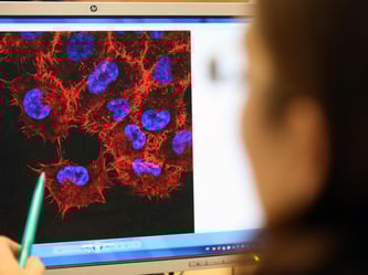 Monitorbild von Melanom-Zellen (schwarzer Hautkrebs): Mainzer Forscher rücken verschiedenen Krebsarten mit einer besonderen Art der Immuntherapie auf den Leib. Foto: Bernd Wüstneck/Archiv