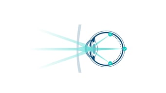 Grafik über die Wirkungsweise von Rodenstock MyCon® Myopie-Brillengläsern