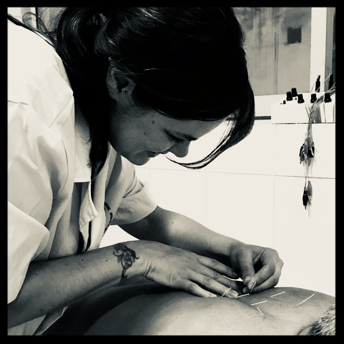 Akupunktur Biel, TCM Biel, Traditionelle Chinesische Medizin acu natura TCM Biel