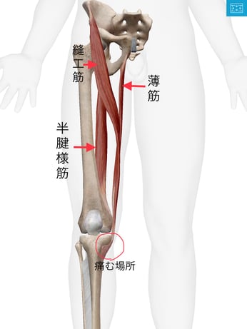 ランニング中の足の痛み