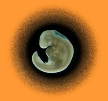 Embryon humain, 4 semaines